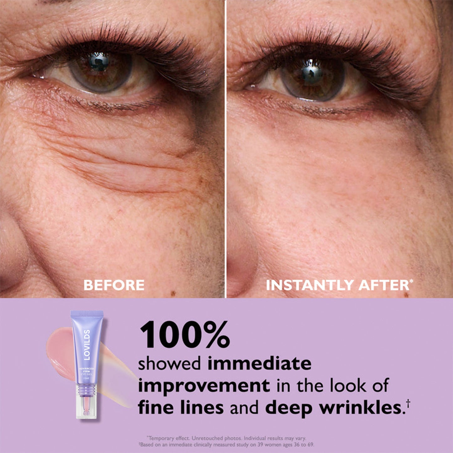 Eye Bag Instant Eraser, Tightens, Firms, & Blurs Wrinkles🔥