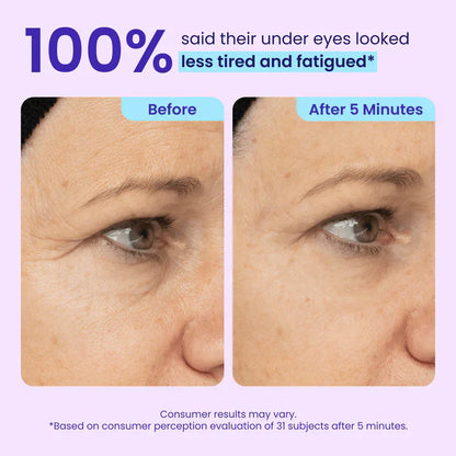 Eye Bag Instant Eraser, Tightens, Firms, & Blurs Wrinkles🔥